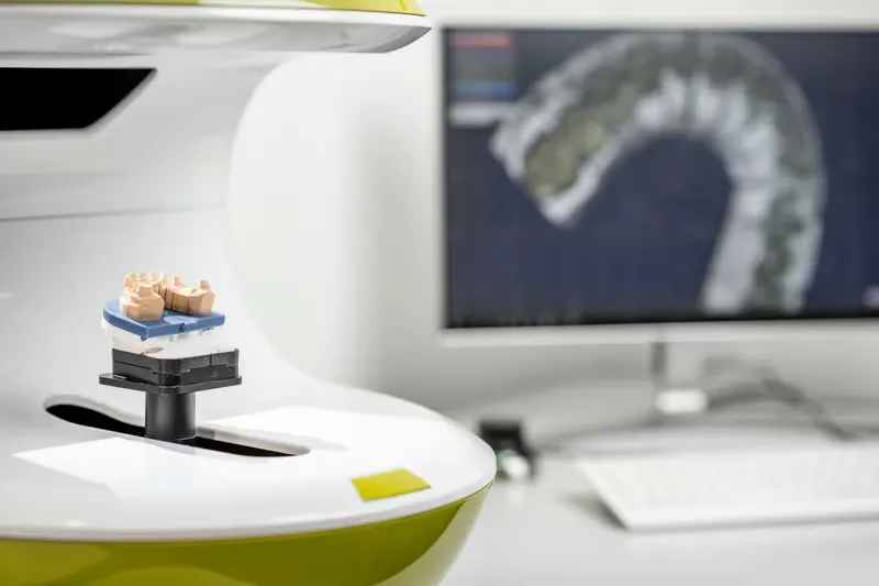 Bel Sorriso Tandklinik Helsingborg'da hassas protez üretimi ve dijital tasarım için çene modeliyle birlikte modern 3D tarayıcı